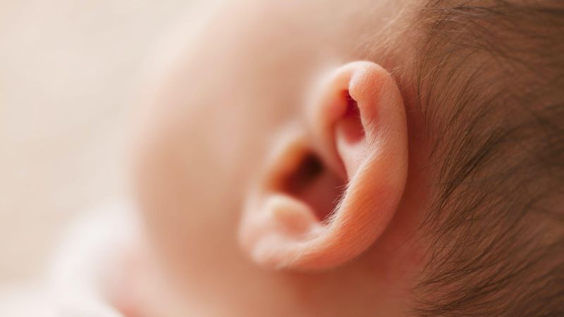 Dấu hiệu nhận biết câm bẩm sinh
